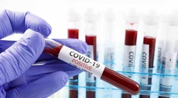 2nd-covid-case-detected-in-cuttack