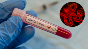 Ebola Outbreak: ଆଫ୍ରିକାରେ ଇବୋଲା ଭାଇରସ ଭୟ; ଗଲାଣି ୮୦ ଜଣଙ୍କ ଜୀବନ