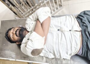 Double Encounter in Angul: ଅନୁଗୋଳରେ ଦୁଇ ସୁନା ଲୁଟେରାଙ୍କୁ ଏନକାଉଣ୍ଟର